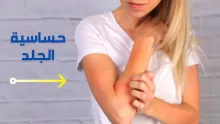 علاج حساسية الجلد وانواعها بالصور