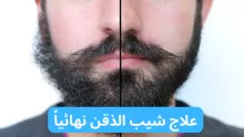 طرق سحرية تساعدك في علاج شيب الذقن نهائيا