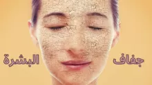 أبرز أسباب جفاف البشرة في الشتاء وطرق علاجها