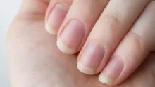 كيف اطول اظافري في أسبوع؟ ونصائح لتفادي تكسرها