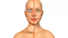 ما هو سبب تبريق العين وطرق العلاج ؟