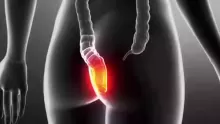 أسباب وأعراض الناسور الشرجي وطرق علاجه