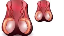 هل المخصي يتزوج؟