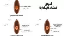 أسباب فشل عملية ترقيع البكارة