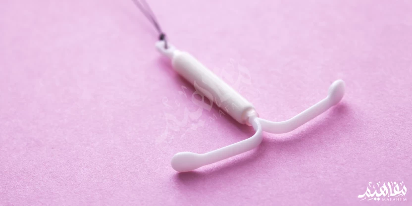 اللولب الهرموني