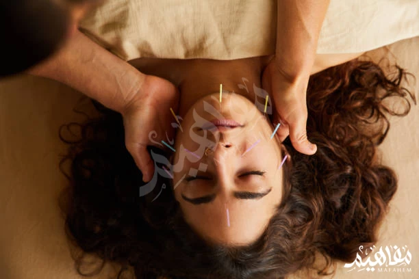 الإبر الصينية