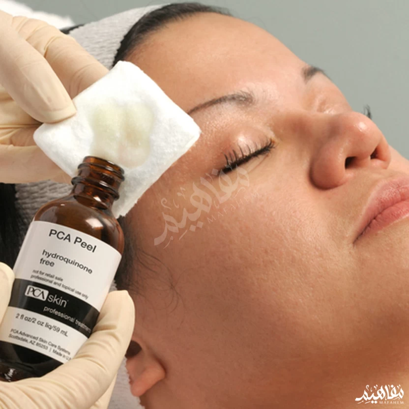 Chemical Peel
