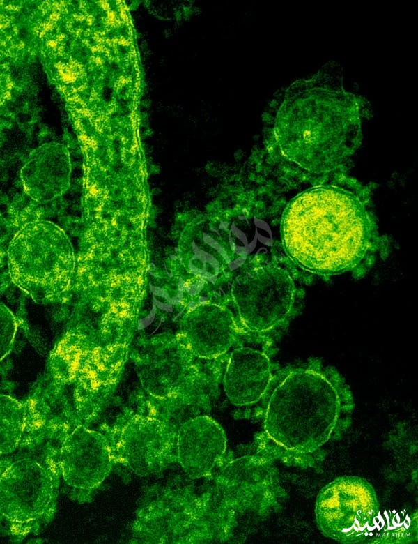 تعريف-البكتيريا تعريف-البكتيريا