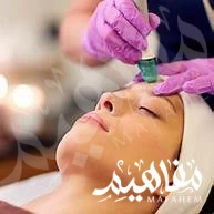 Chemical Peel
