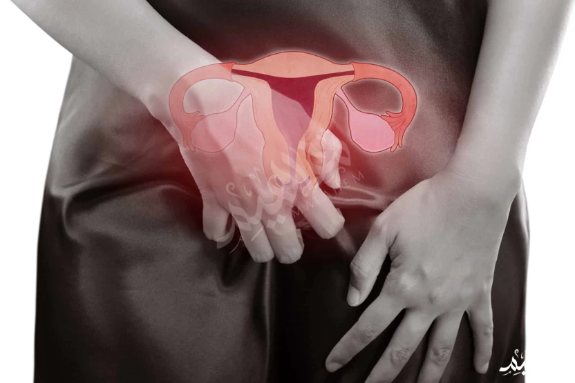 علاج-حكة-المهبل-والشفرتين علاج-حكة-المهبل-والشفرتين