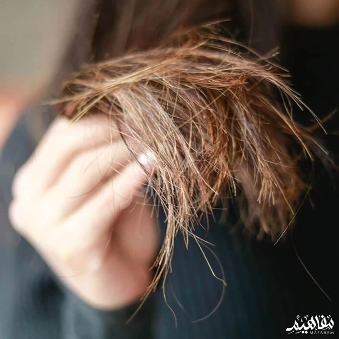 ديرمفيت وتقصف الشعر