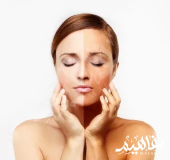 ديرمفيت للتبيض