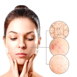 كريم ماربالين للمسام الواسعة كريم ماربالين للمسام الواسعة