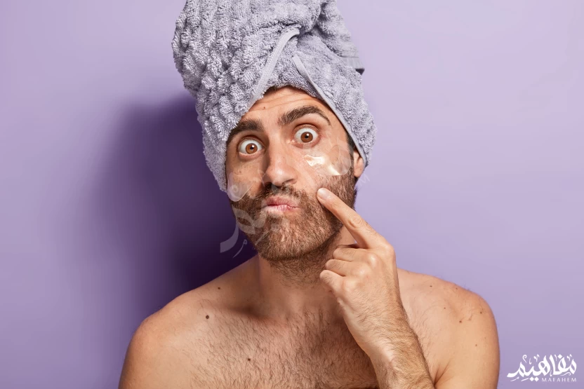 حب الشباب حب الشباب