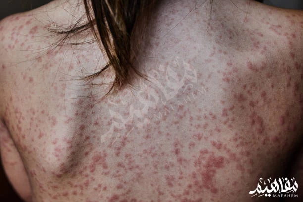 الحبوب في منطقة الظهر