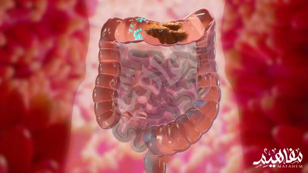 clean colon clean colon