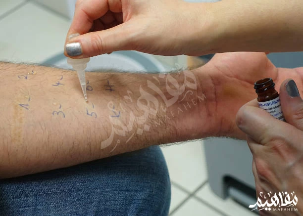 هيستامين هيستامين