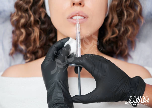 lips filler lips filler