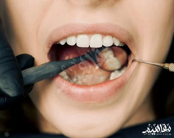 Oral health Oral health