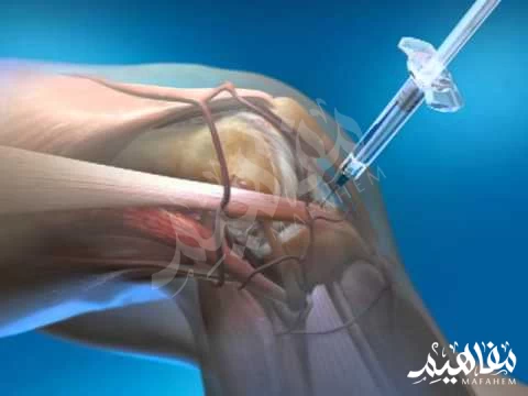 الكورتيزون الكورتيزون