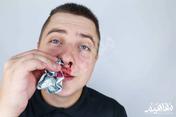 a nosebleed   a nosebleed