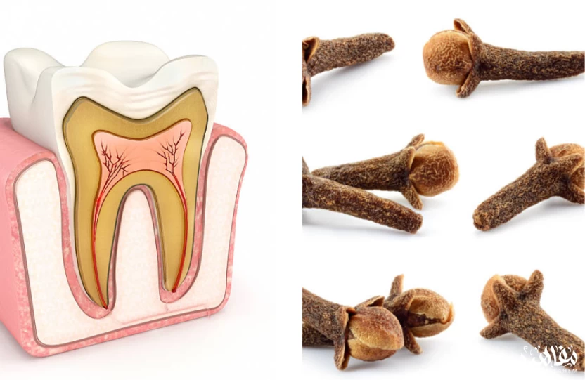 القرنفل لعلاج عصب الاسنان القرنفل لعلاج عصب الاسنان