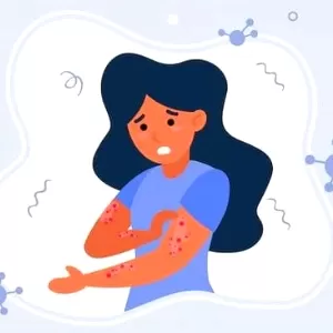 نبذة عن حساسية الطعام