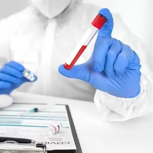 شروط تحليل فيتامين د شروط تحليل فيتامين د