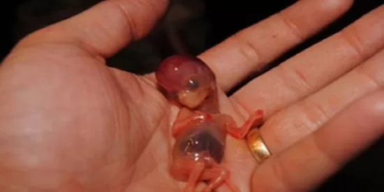 طرق-أخرى-للاجهاض-المنزلي طرق-أخرى-للاجهاض-المنزلي