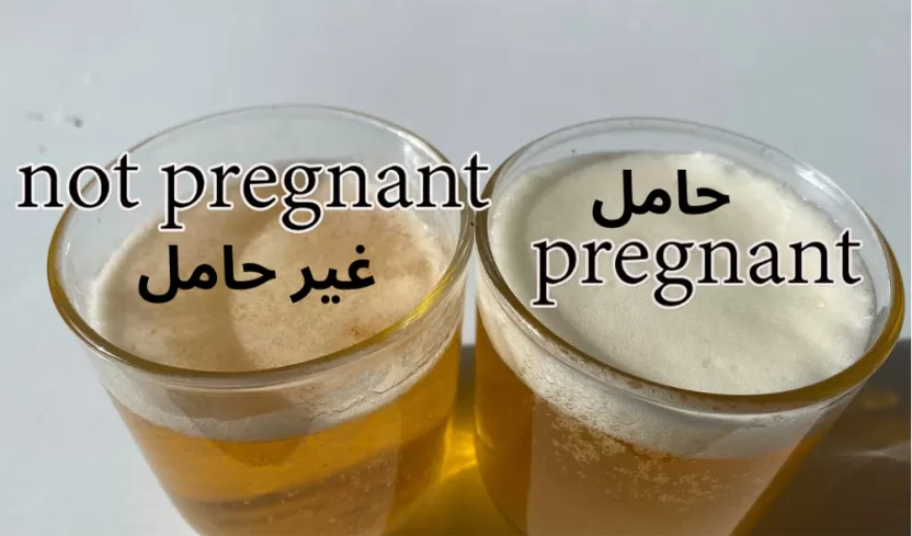 شكل رغوة تحليل الحمل بالكلور