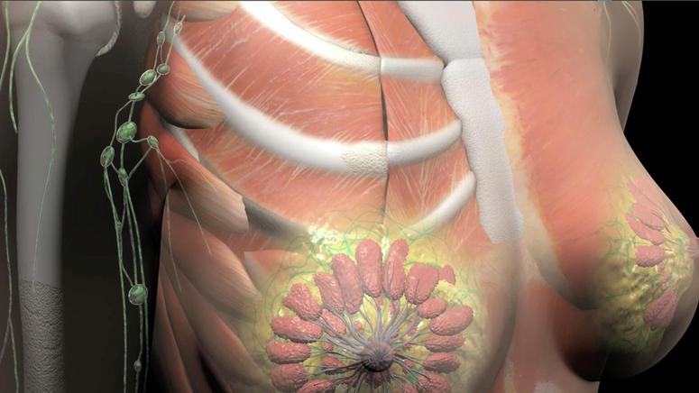 أعراض سرطان الثدي أعراض سرطان الثدي