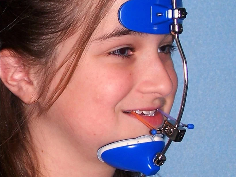 علاج العضة المعكوسة علاج العضة المعكوسة