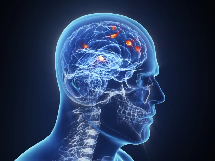 تقوية-الجهاز-العصبي تقوية-الجهاز-العصبي